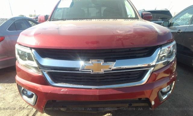 Photo 5 VIN: 1GCGSCEN7J1228541 - CHEVROLET COLORADO 