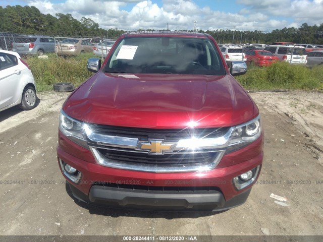 Photo 5 VIN: 1GCGTCEN5H1243644 - CHEVROLET COLORADO 