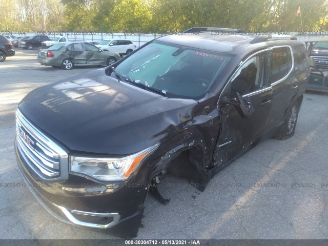 Photo 1 VIN: 1GKKNMLS3HZ157662 - GMC ACADIA 