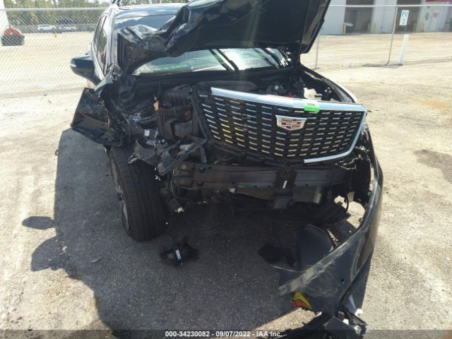 Photo 5 VIN: 1GYKNCRS9LZ117327 - CADILLAC XT5 