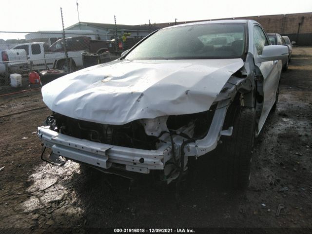 Photo 5 VIN: 1HGCT2B85HA000375 - HONDA ACCORD COUPE 