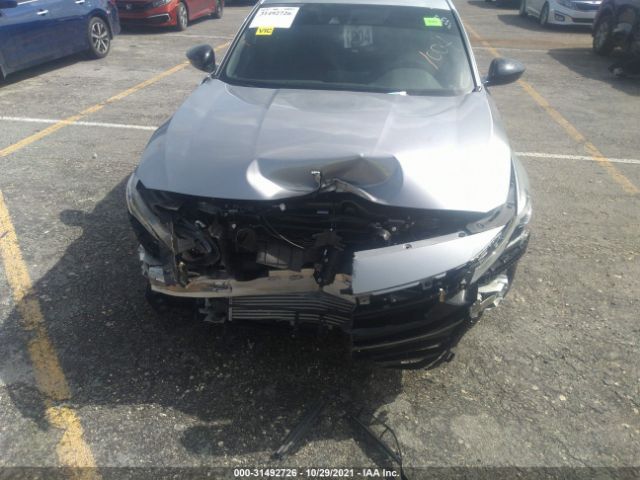 Photo 5 VIN: 1HGCV1F30MA015797 - HONDA ACCORD SEDAN 