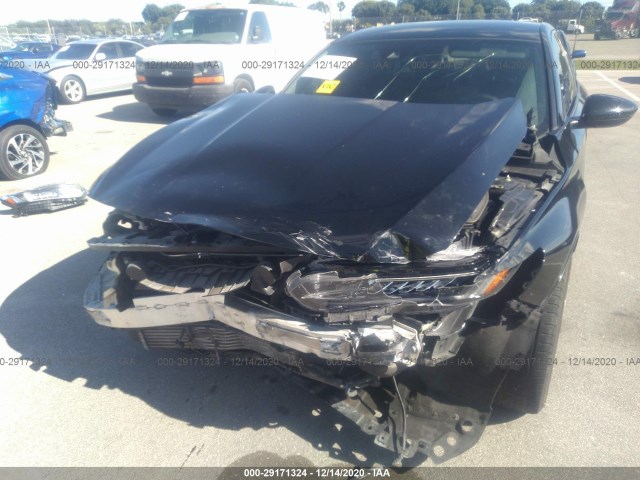 Photo 5 VIN: 1HGCV1F32JA000987 - HONDA ACCORD SEDAN 