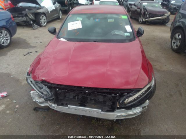 Photo 5 VIN: 1HGCV1F33MA011064 - HONDA ACCORD SEDAN 