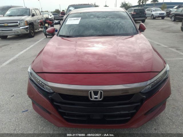 Photo 5 VIN: 1HGCV1F34JA159736 - HONDA ACCORD SEDAN 