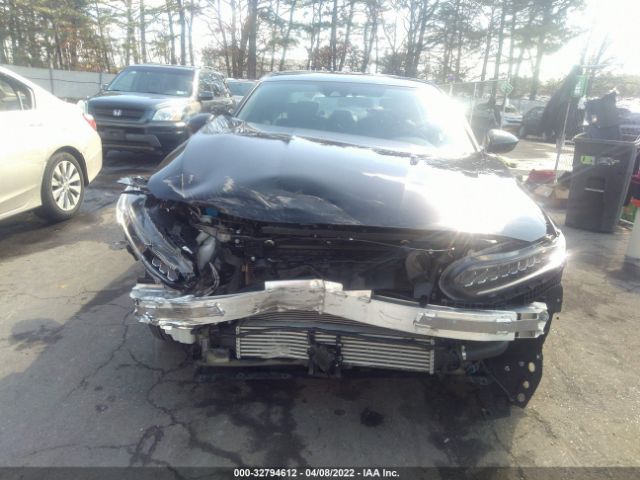 Photo 5 VIN: 1HGCV1F34MA003460 - HONDA ACCORD SEDAN 