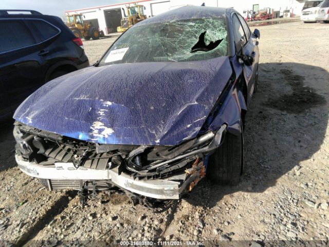 Photo 5 VIN: 1HGCV1F35JA125806 - HONDA ACCORD SEDAN 