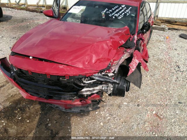 Photo 5 VIN: 1HGCV1F37LA119069 - HONDA ACCORD SEDAN 