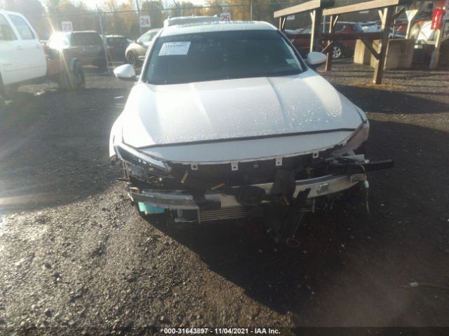 Photo 5 VIN: 1HGCV1F43LA125198 - HONDA ACCORD SEDAN 