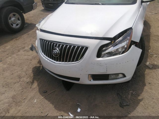 Photo 5 VIN: 2G4G15GV7B9165364 - BUICK REGAL 