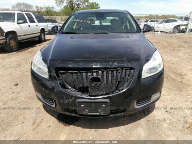 Photo 5 VIN: 2G4GN5EC5B9185991 - BUICK REGAL 