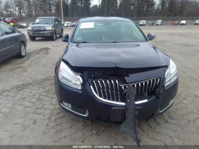 Photo 5 VIN: 2G4GR5EK3C9174601 - BUICK REGAL 