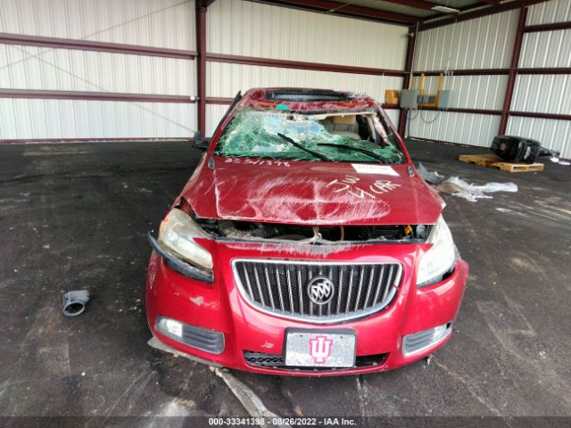 Photo 5 VIN: 2G4GR5ER8D9243152 - BUICK REGAL 