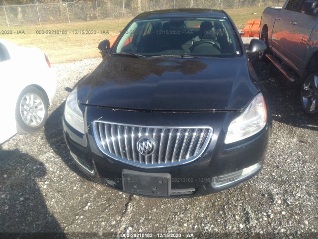 Photo 5 VIN: 2G4GS5EC2B9177467 - BUICK REGAL 