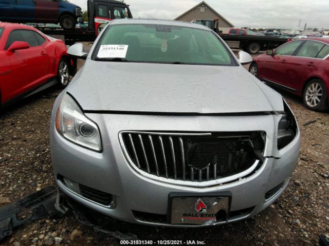 Photo 5 VIN: 2G4GX5GV3B9175503 - BUICK REGAL 