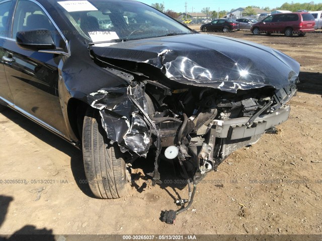 Photo 5 VIN: 2G61M5S31J9126309 - CADILLAC XTS 