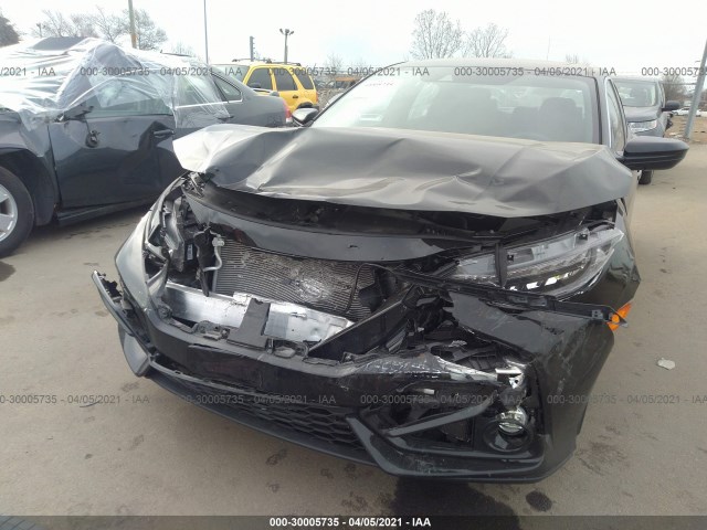 Photo 5 VIN: 2HGFC1E54LH709057 - HONDA CIVIC SI SEDAN 