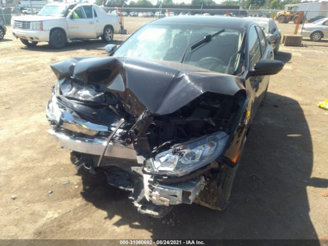 Photo 5 VIN: 2HGFC2F53JH562618 - HONDA CIVIC SEDAN 