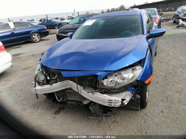 Photo 5 VIN: 2HGFC2F57HH511519 - HONDA CIVIC SEDAN 