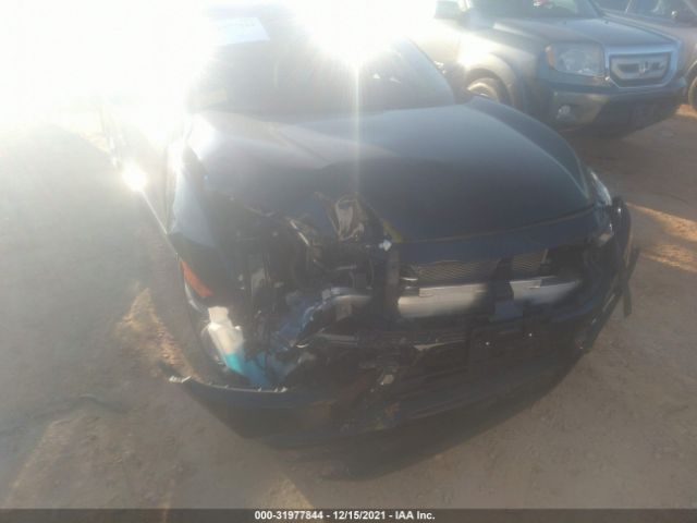 Photo 5 VIN: 2HGFC2F60LH591683 - HONDA CIVIC SEDAN 