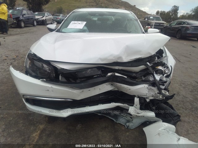 Photo 5 VIN: 2HGFC2F61LH557137 - HONDA CIVIC SEDAN 