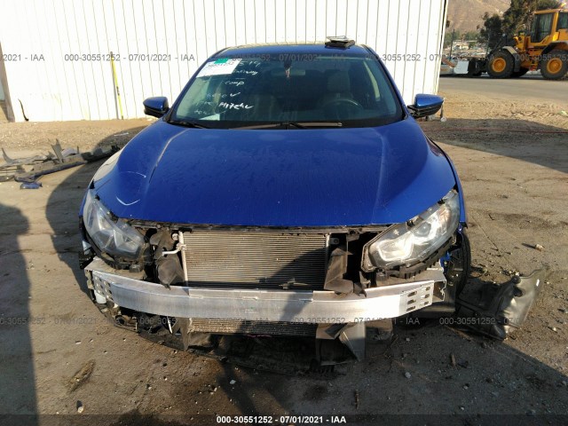 Photo 5 VIN: 2HGFC2F7XJH554081 - HONDA CIVIC SEDAN 