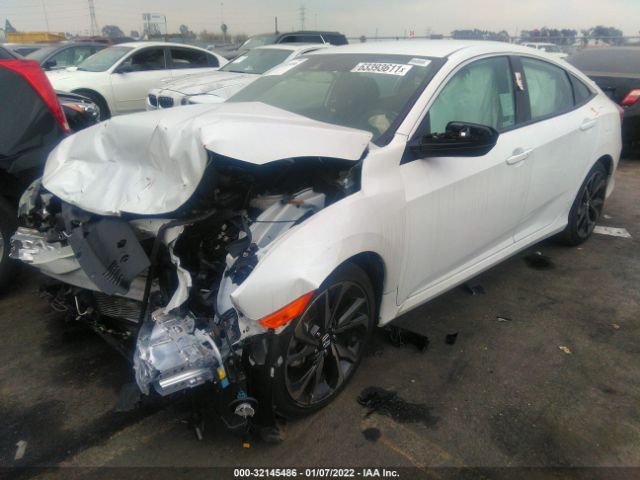 Photo 1 VIN: 2HGFC2F81MH557755 - HONDA CIVIC SEDAN 