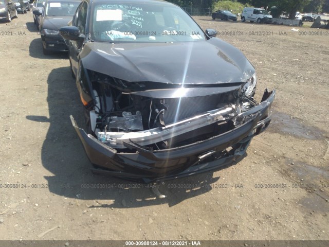 Photo 5 VIN: 2HGFC2F89LH536702 - HONDA CIVIC SEDAN 