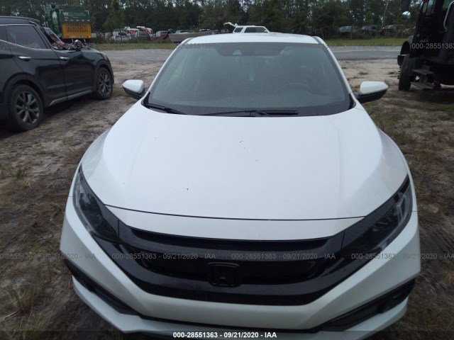 Photo 5 VIN: 2HGFC4B83LH301326 - HONDA CIVIC COUPE 