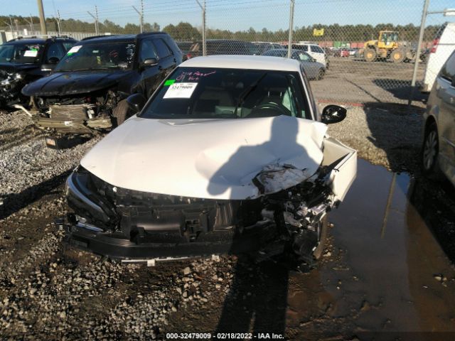 Photo 5 VIN: 2HGFE2F51NH550354 - HONDA CIVIC SEDAN 