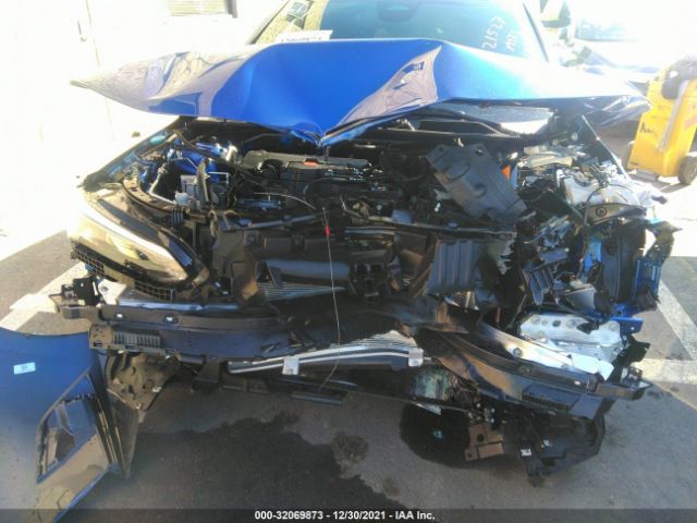 Photo 5 VIN: 2HGFE2F58NH518775 - HONDA CIVIC SEDAN 