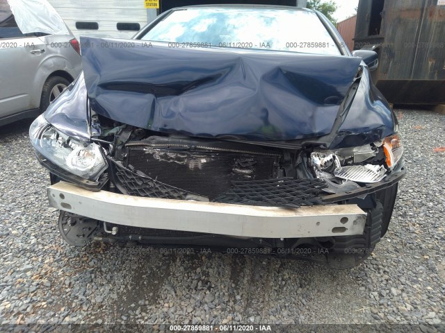 Photo 5 VIN: 2HGFG1B60BH509163 - HONDA CIVIC CPE 