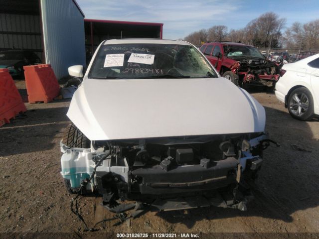 Photo 5 VIN: 3MZBN1W39HM135887 - MAZDA 3 4-DOOR 