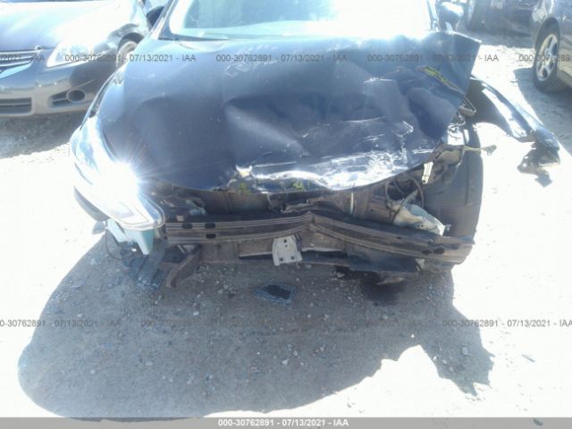 Photo 5 VIN: 3N1AB7AP0HL683354 - NISSAN SENTRA 