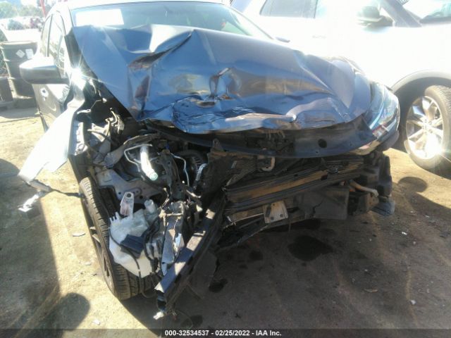 Photo 5 VIN: 3N1AB7AP0HY302721 - NISSAN SENTRA 