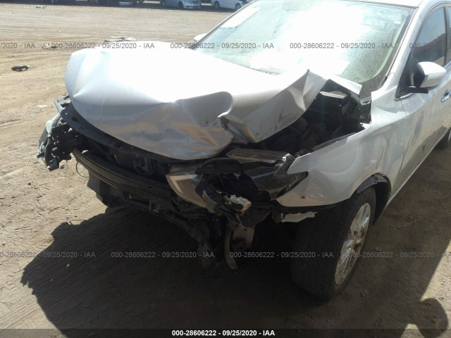 Photo 5 VIN: 3N1AB7AP1JL656315 - NISSAN SENTRA 