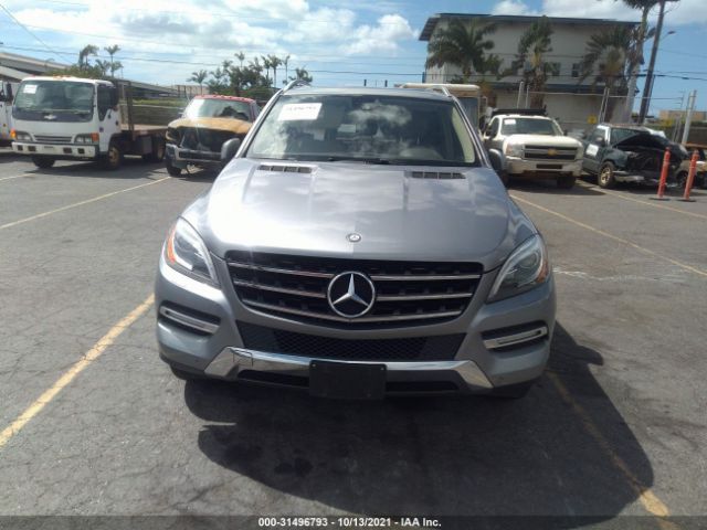 Photo 5 VIN: 4JGDA2EB3CA081770 - MERCEDES-BENZ M-CLASS 