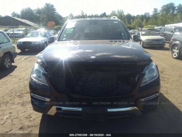 Photo 5 VIN: 4JGDA5HB2FA593375 - MERCEDES-BENZ M-CLASS 