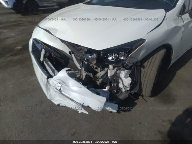 Photo 5 VIN: 4S3GTAA66H3718029 - SUBARU IMPREZA 