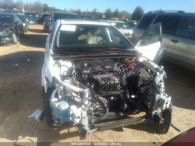 Photo 5 VIN: 4T1B11HK0JU652902 - TOYOTA CAMRY 