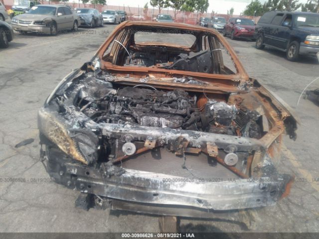 Photo 5 VIN: 4T1B11HK6KU264672 - TOYOTA CAMRY 