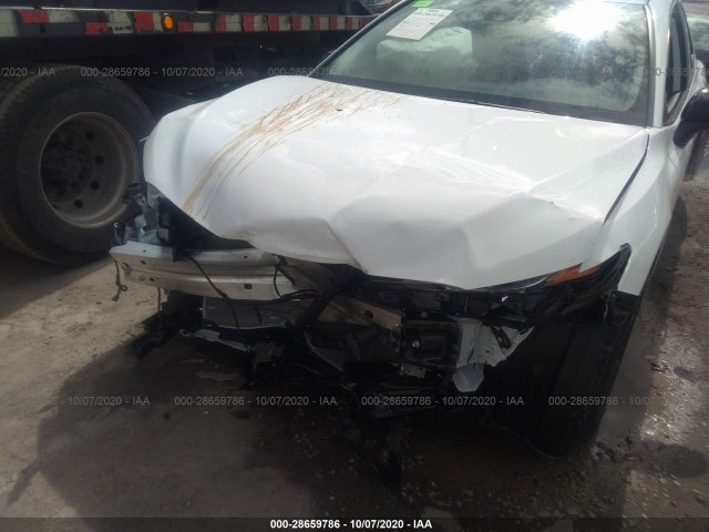 Photo 5 VIN: 4T1G11AK9LU381728 - TOYOTA CAMRY 