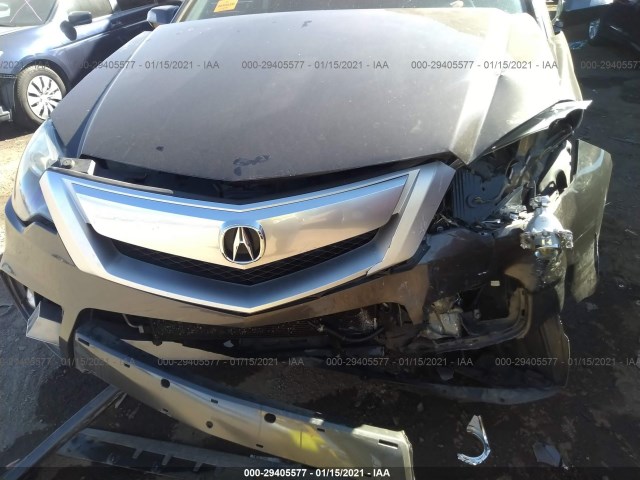 Photo 5 VIN: 5J8TB1H2XBA003523 - ACURA RDX 