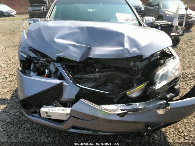 Photo 5 VIN: 5J8TB3H34EL003983 - ACURA RDX 