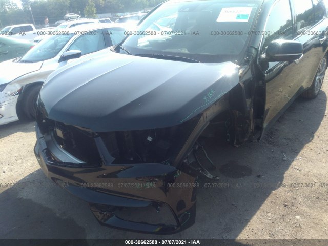 Photo 5 VIN: 5J8YD4H58JL007214 - ACURA MDX 