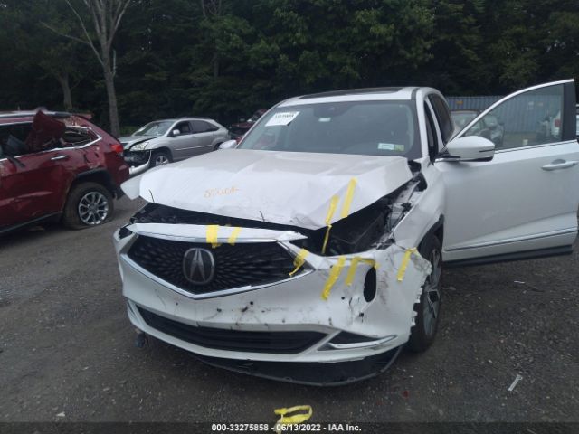 Photo 5 VIN: 5J8YE1H4XNL009622 - ACURA MDX 