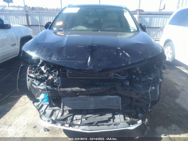 Photo 5 VIN: 5LMCJ1C98HUL24501 - LINCOLN MKC 