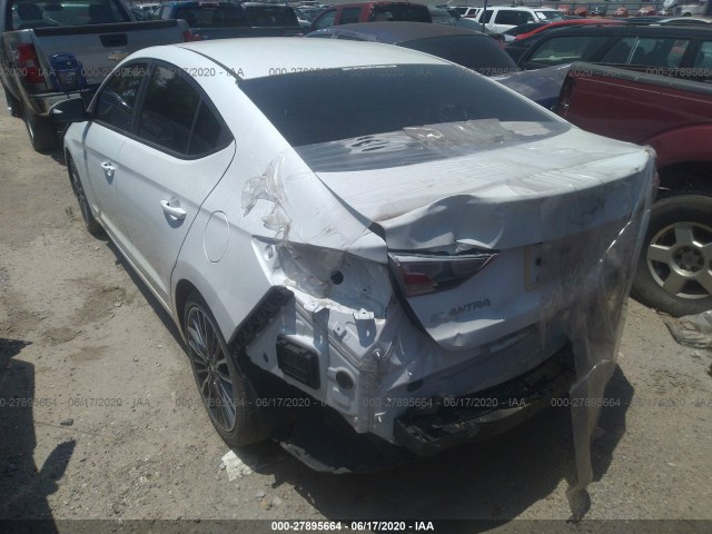 Photo 2 VIN: 5NPD74LF2JH244712 - HYUNDAI ELANTRA 