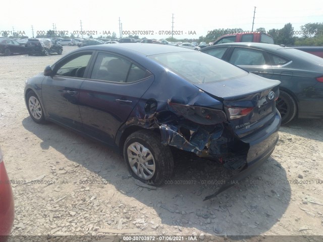 Photo 2 VIN: 5NPD74LF2JH274843 - HYUNDAI ELANTRA 