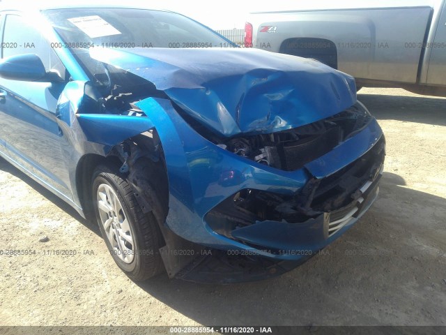 Photo 5 VIN: 5NPD74LF5HH207678 - HYUNDAI ELANTRA 